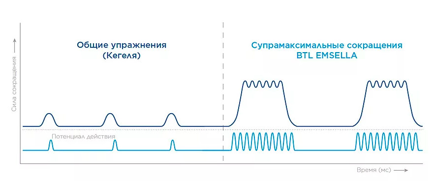 Стул для укрепления мышц тазового дна