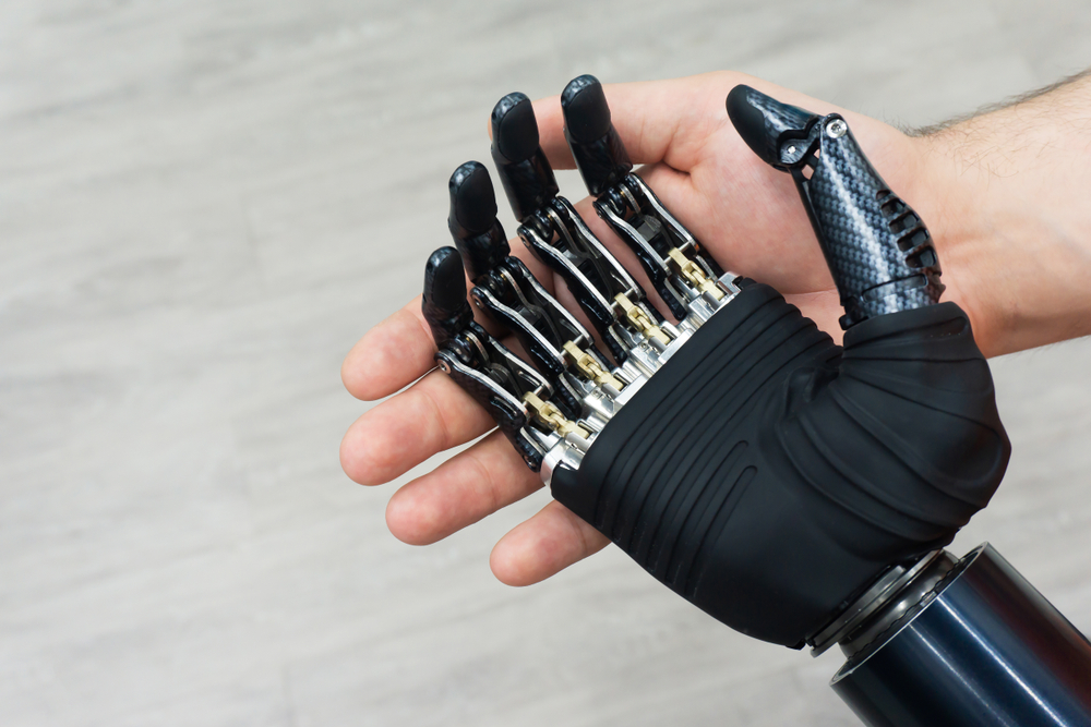 Бионические протезы: на что они способны, и когда мы станем киборгами? | РБК Тренды