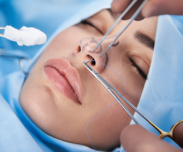 Можно ли исправить искривление носовой перегородки с помощью пластики?