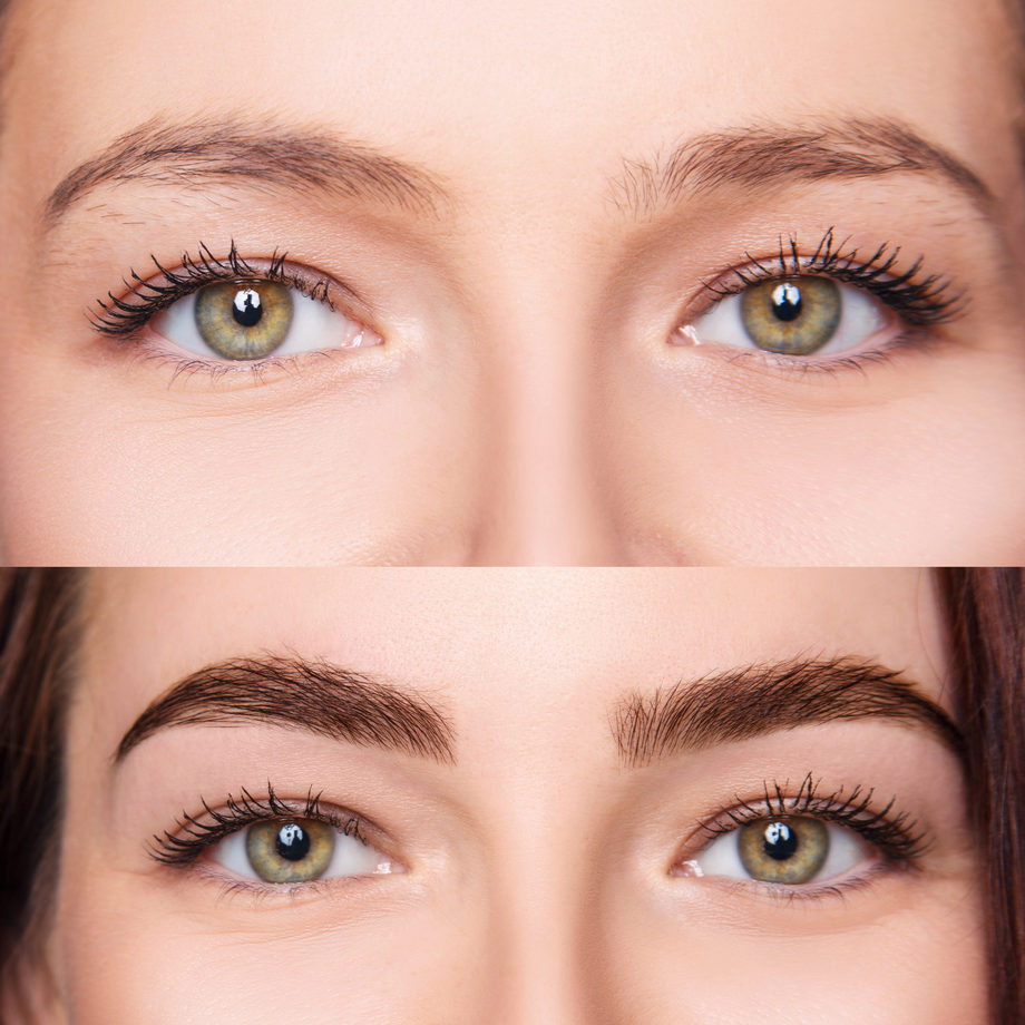 Enhance Eyebrows before and after treatment