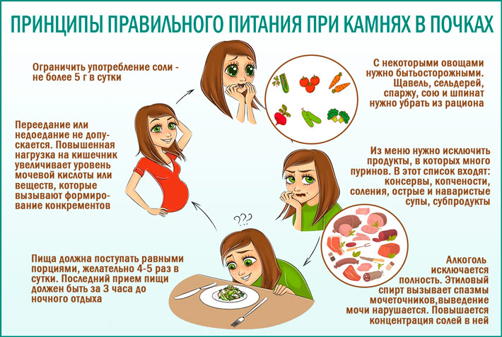 Нефроптоз - симптомы, признаки и лечение опущения почки в Москве в «СМ-Клиника»