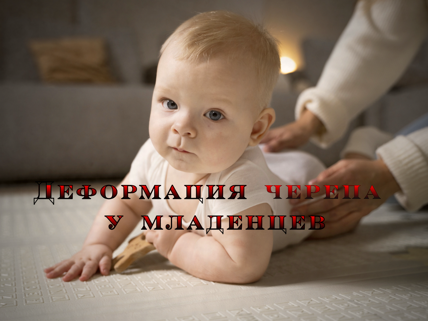 Деформация черепа у младенцев