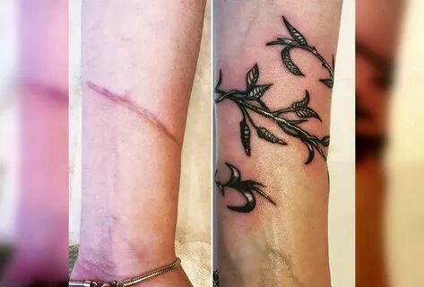 Тату вместо шрама: 30 примеров, когда фантазия и мастерство татуировщиков помогают людям