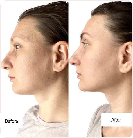 Before and after