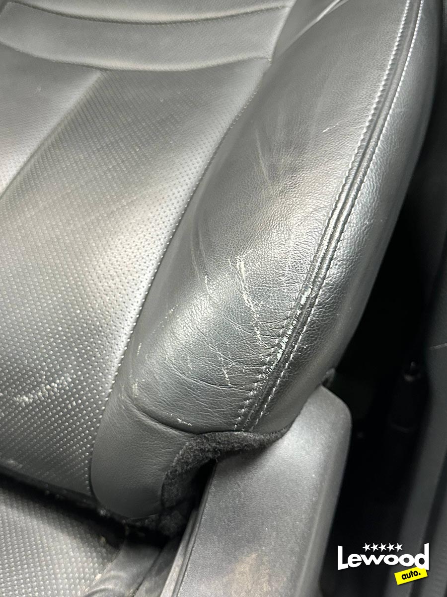 реставрация боковой поддержки