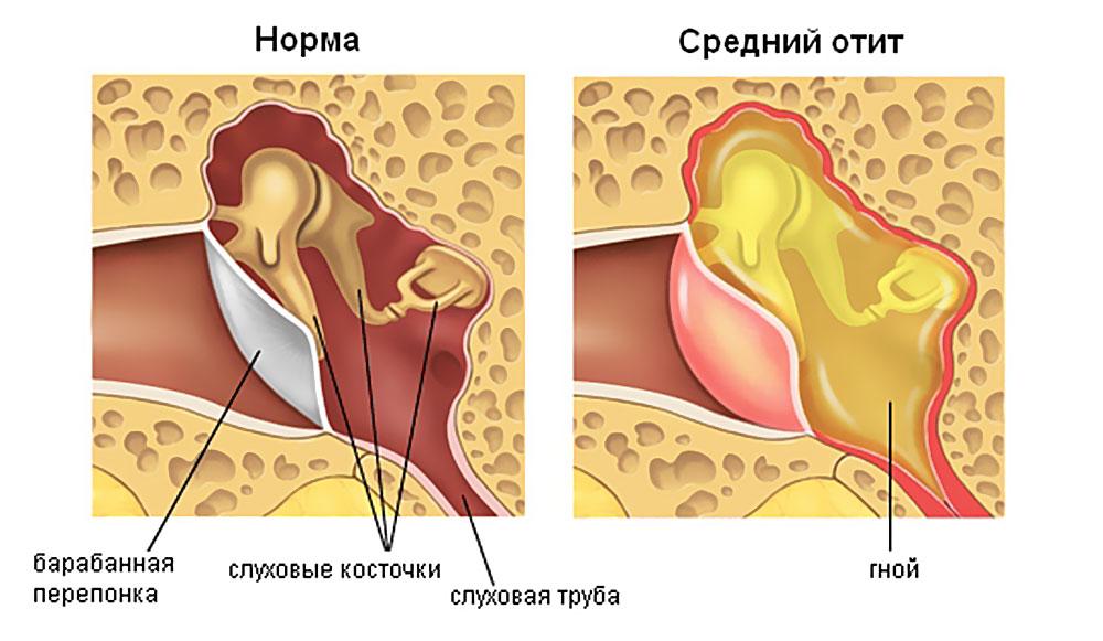 В памяти остались тяжелые картины стоял такой грохот что перепонки давило