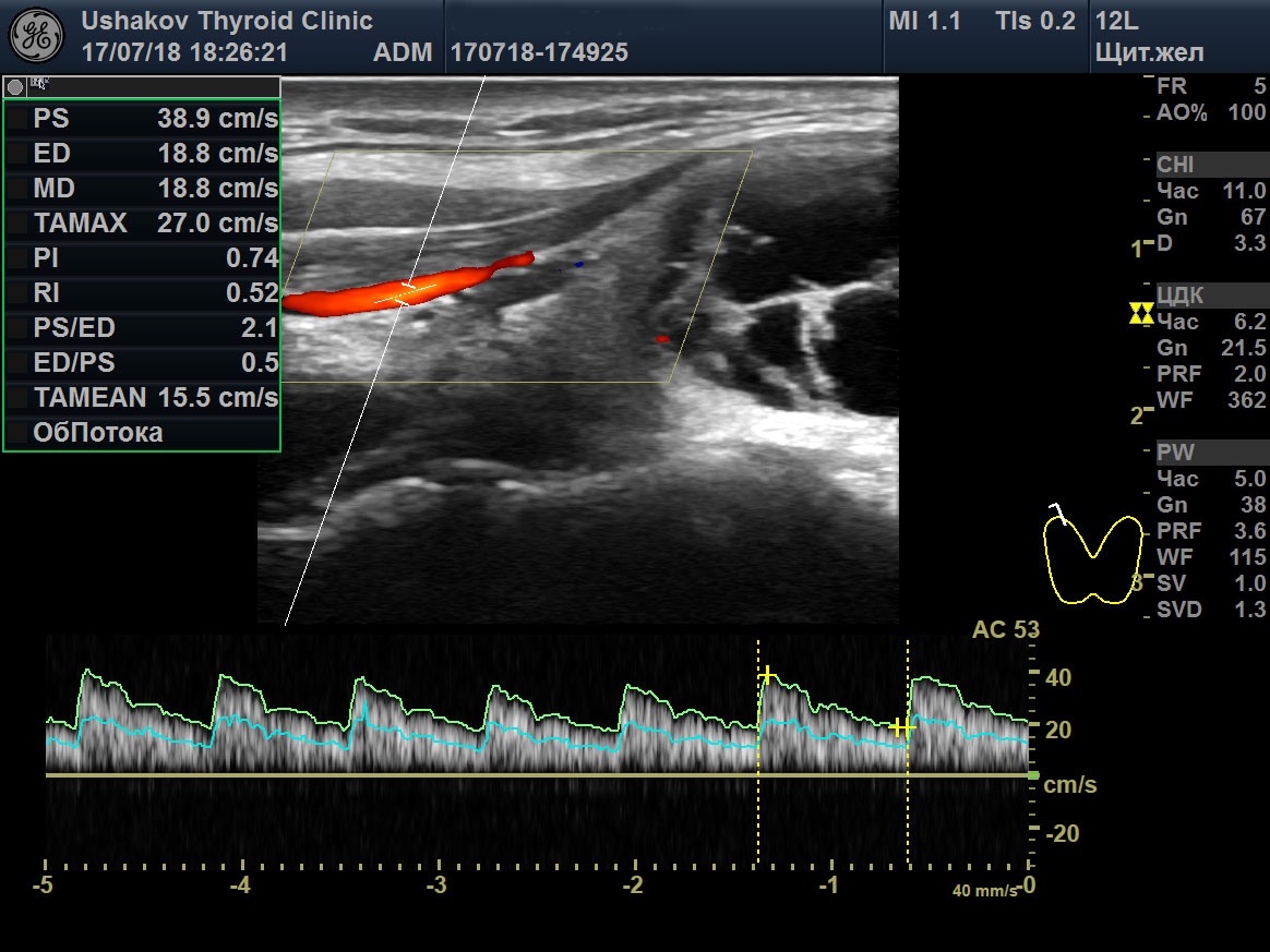 Видеолекции узи изранов. УЗИ щитовидной железы протокол Изранов. Изранов протоколы УЗИ.
