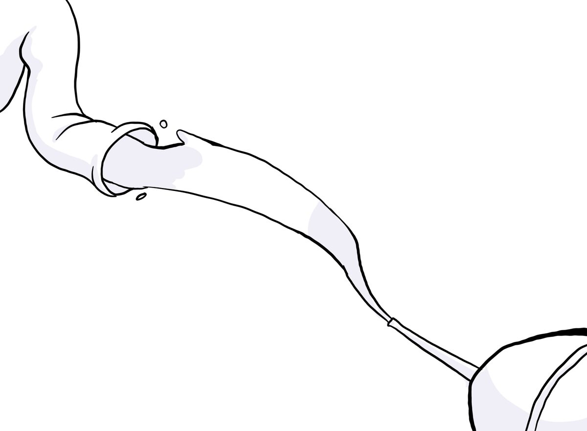 Лечение язвенного колита кишечника при помощи ТФМ в Санкт-Петербурге и ...