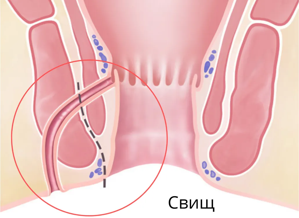 схема анального прохода