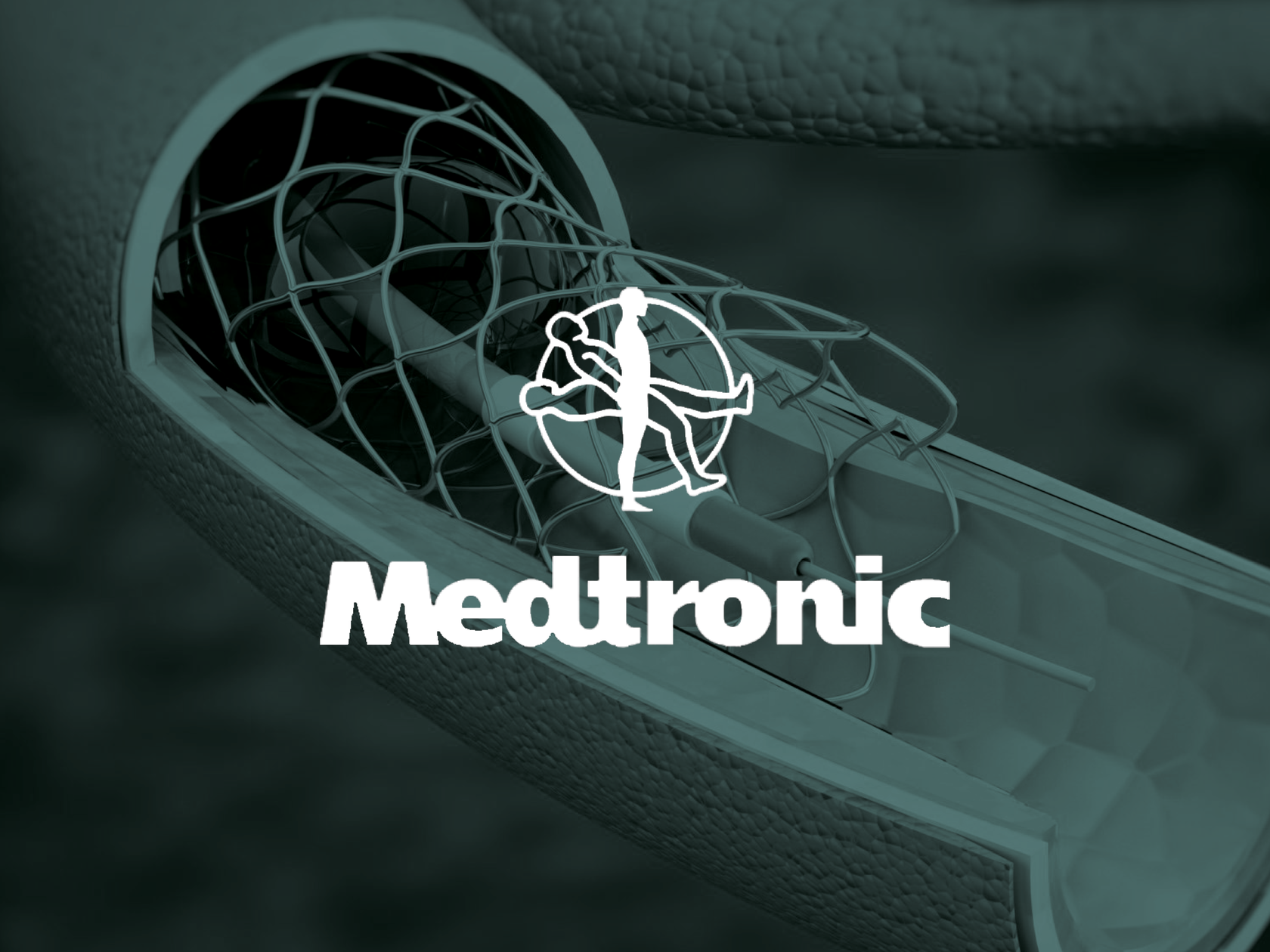 MEDTRONIC