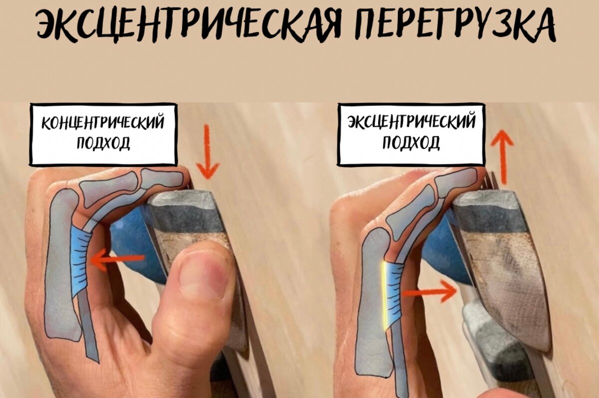 Травмы кольцевых связок при занятиях скалолазанием и как их избежать