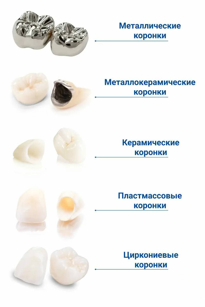 Установка коронок в стоматологической клинике в Жуковском