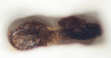 Лечение корней под микроскопом