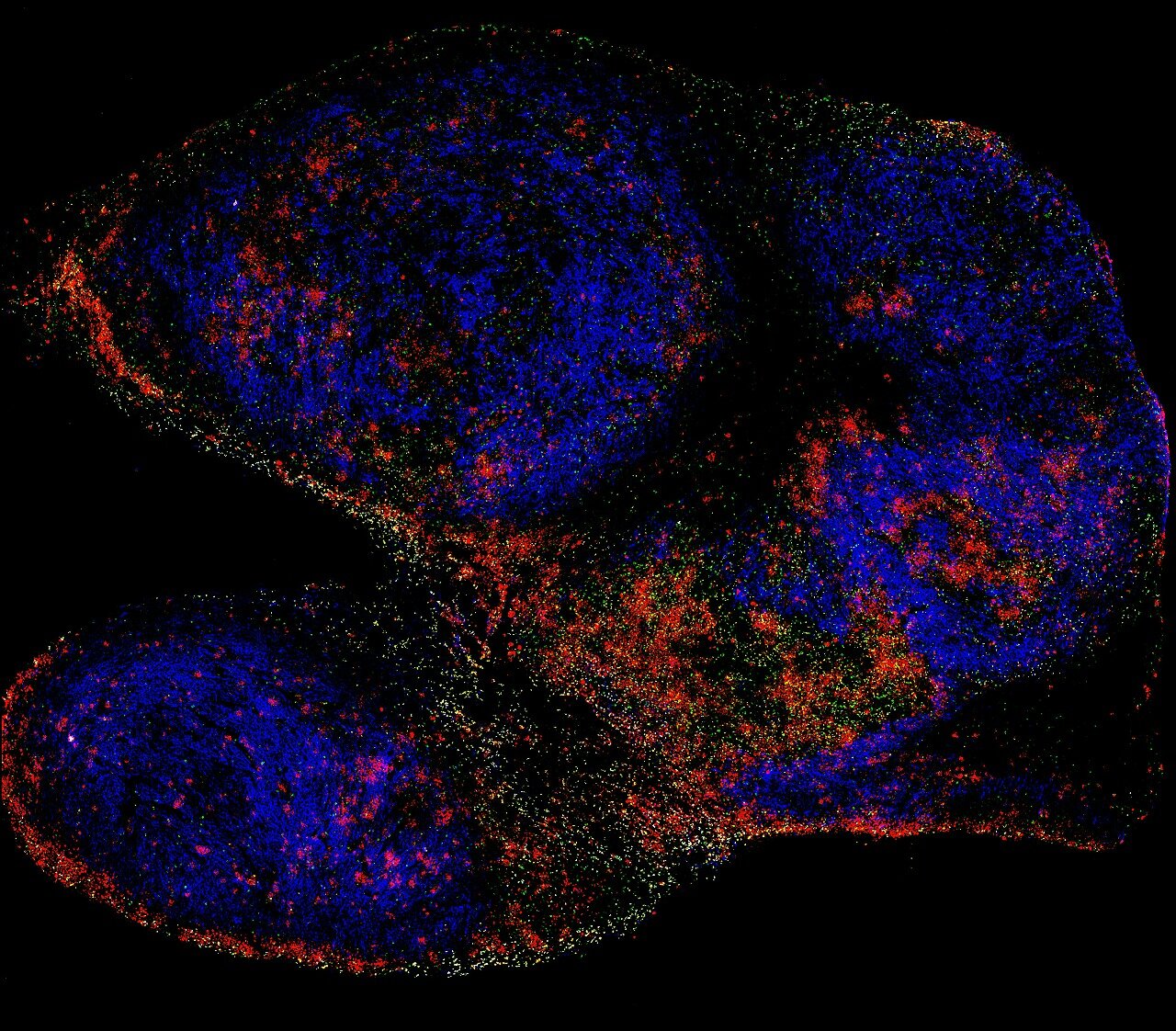 T Cell vs Cancer