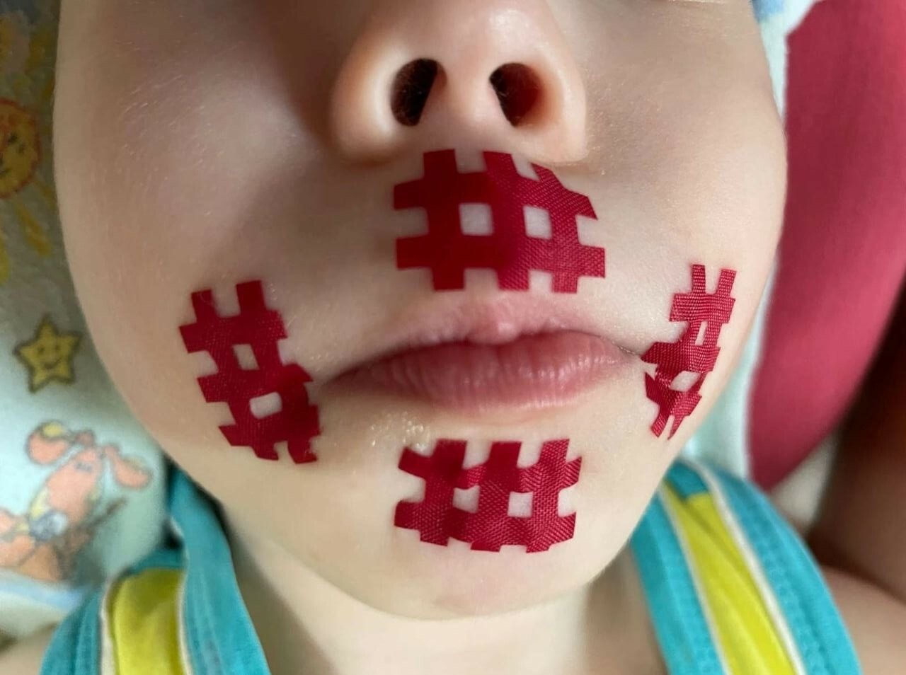 Тейпирование