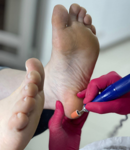 Обработка стоп