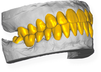 Зуботехническая лаборатория Москва