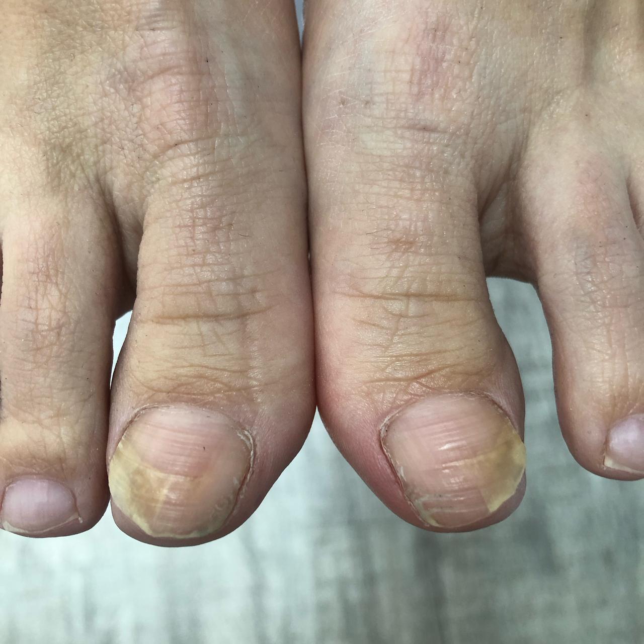 центр подологии и эстетики, адрес центр подологии, сайт центр подологии, мастер педикюра, аппаратный педикюр, профессиональный педикюр, восстановление ногтей, скрученные ногти