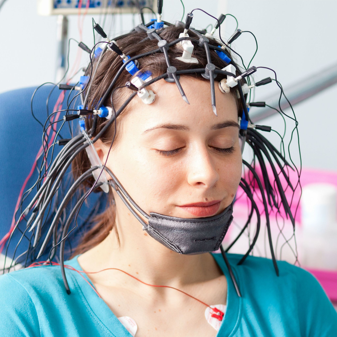 ЭЭГ головного мозга