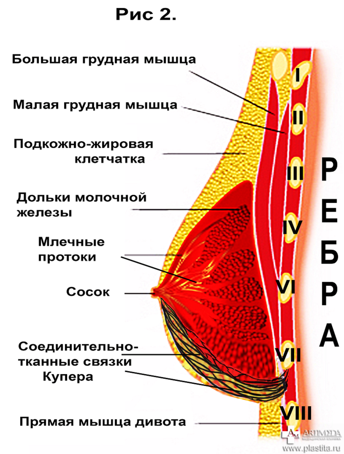 Маммопластика