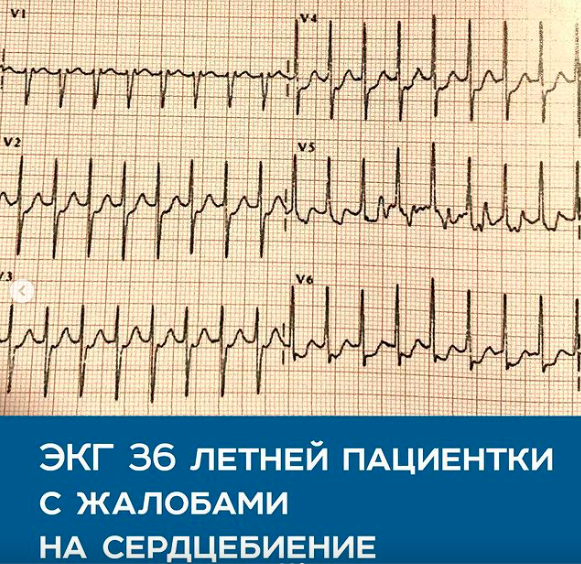 Экг доктор. Доктор и ЭКГ. ЭКГ В школе. Кардиограмма в школе.