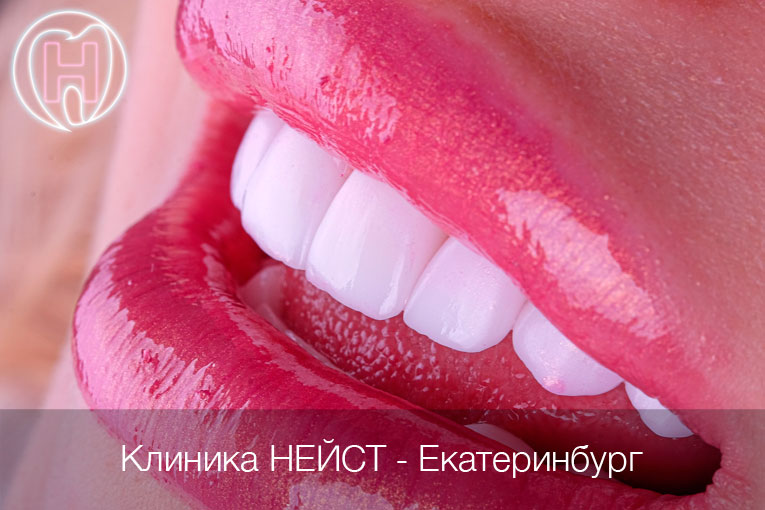 керамические виниры цвет Блич 1 (Bleach 1)