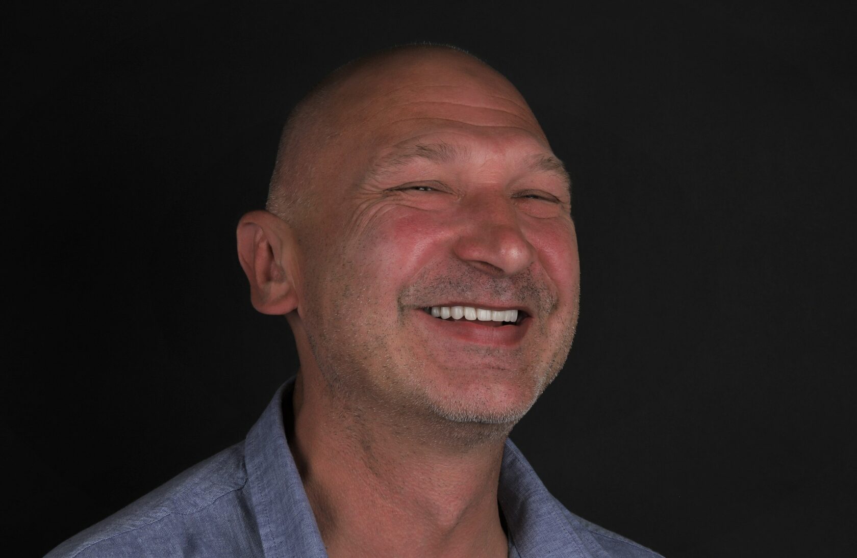 All-on-4, All-in-4 имплантация, протезирование, вернуть зубы, протезирование на имплантах, всё-на-4, все-на-четырех, протезирование зубов