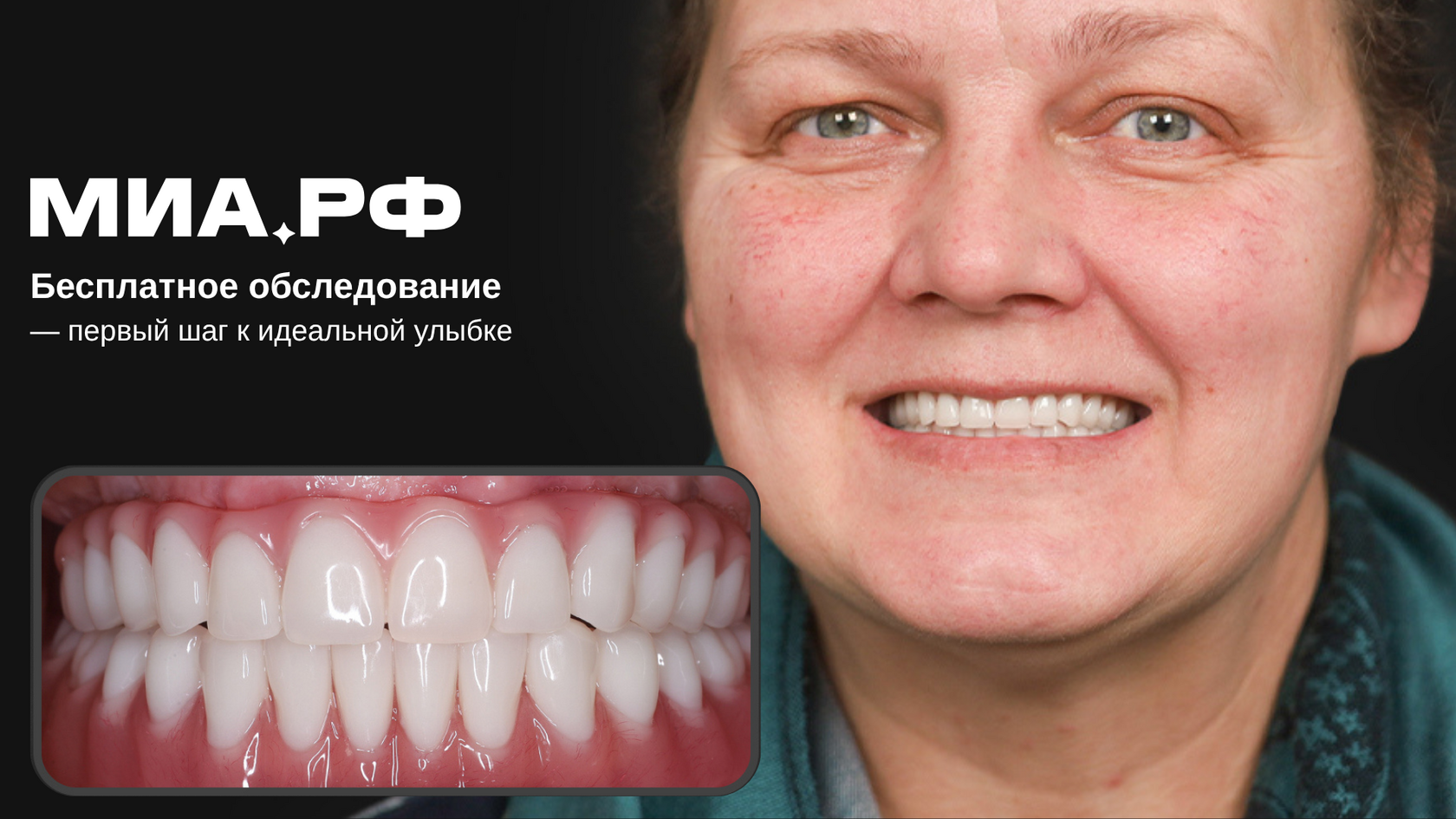 После