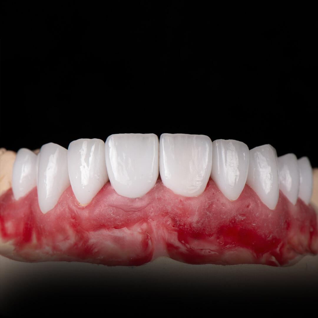 Зуботехническая лаборатория москва