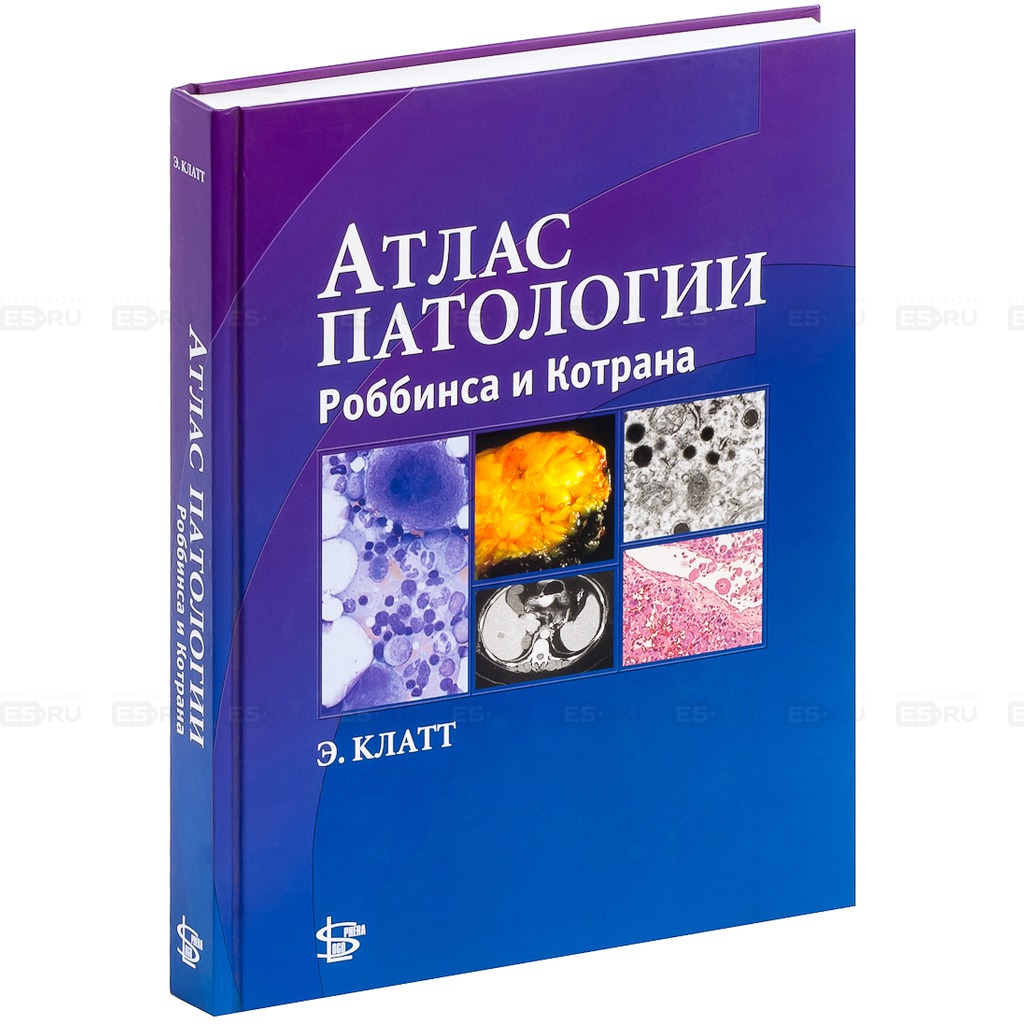 Основы патологии. Патология Роббинс и Котран. Атлас патологии Роббинса и Котрана Клатт. Клатт атлас патологии. Роббинс патологическая анатомия.