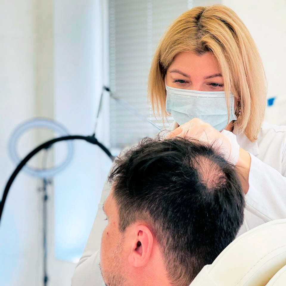 Облысение: лечение андрогенной, очаговой и гнездной алопеции у мужчин ...