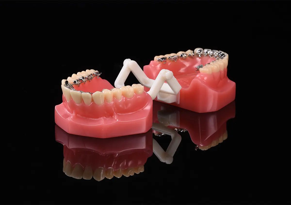 Лингвальные брекеты, напечатанные на 3D-принтере Riton M-150D