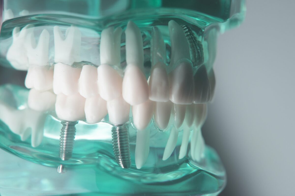 Доктор Смайл — стоматологическая клиника в Рязани для всей семьи | Импланта...