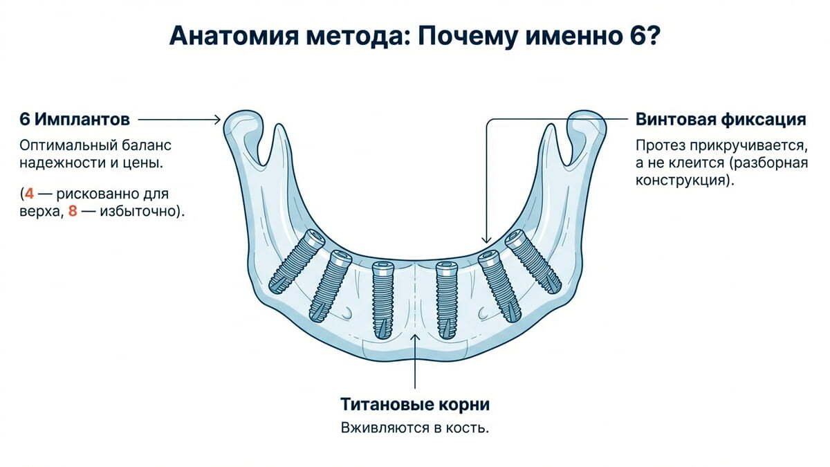 Временный протез как устроен и зачем нужен?