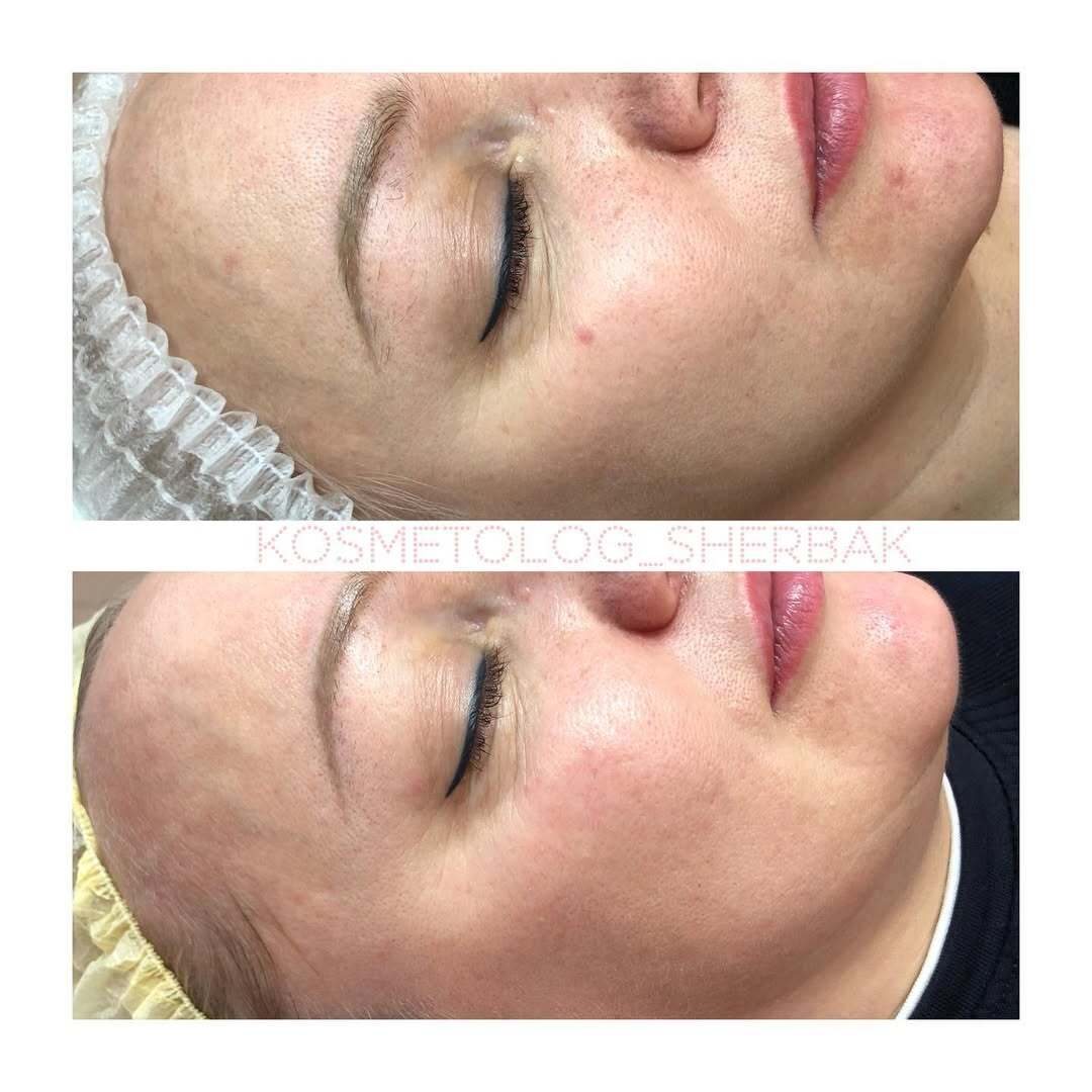 Индивидуальный подбор домашнего ухода в клинике PradusCOSMO, Санкт-Петербург. Косметологический анализ кожи и рекомендация профессиональной косметики