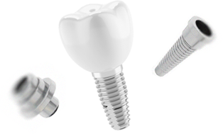 имплантат зуба