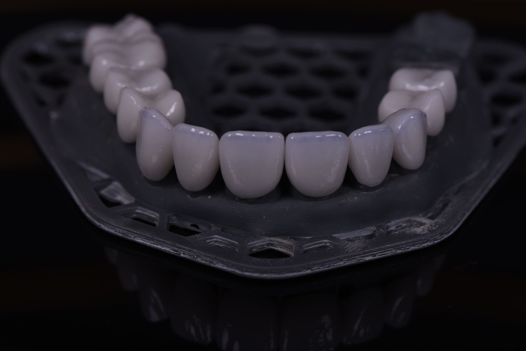 3D-моделирование имплантации в цифровой стоматологии