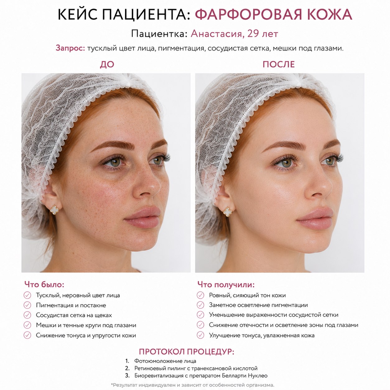 Кейс пациента до и после