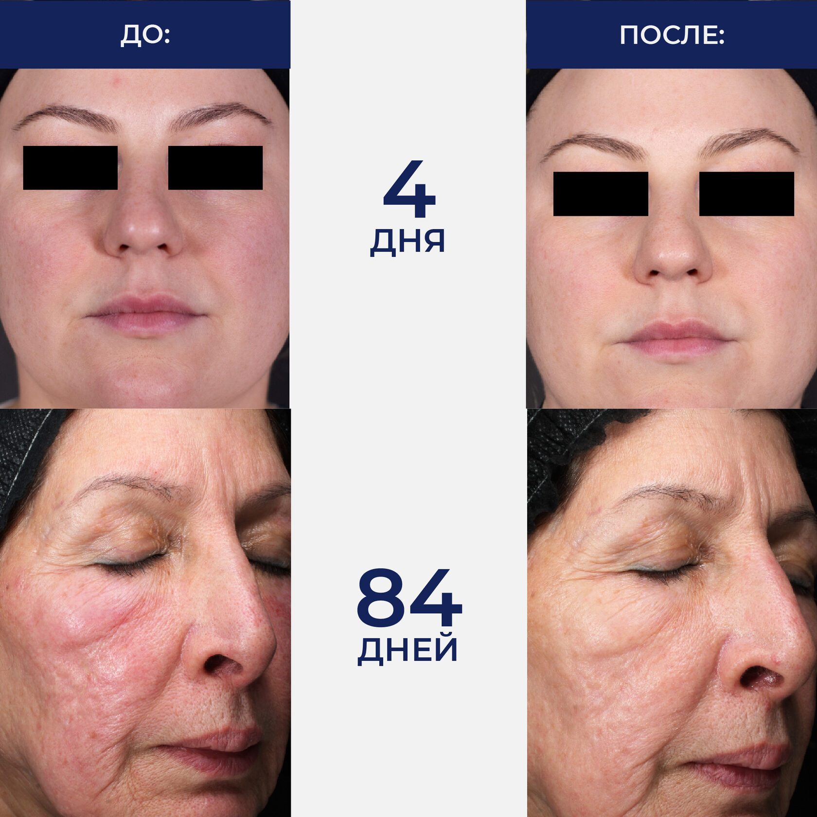 IS CLINICAL Retinol Emulsion 0.3 — купить с доставкой по СКФО и Москве