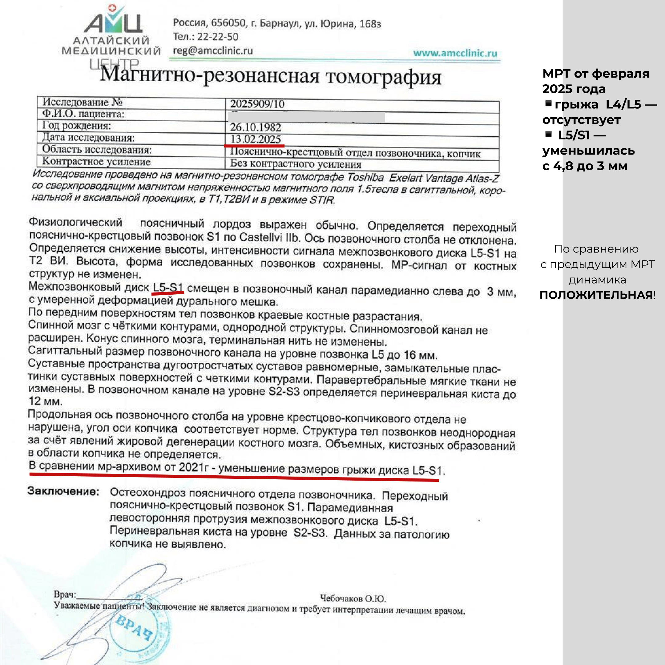 МРТ после лечения — исчезновение грыжи L4/L5
