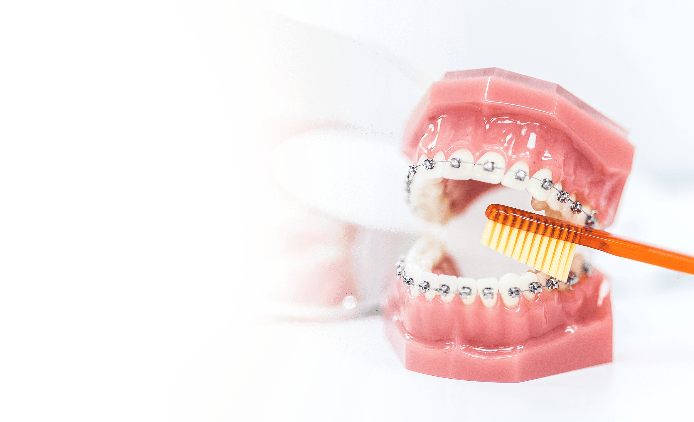 Брекеты оренбург. Стоматология брекеты. Гигиена полости рта с брекетами.