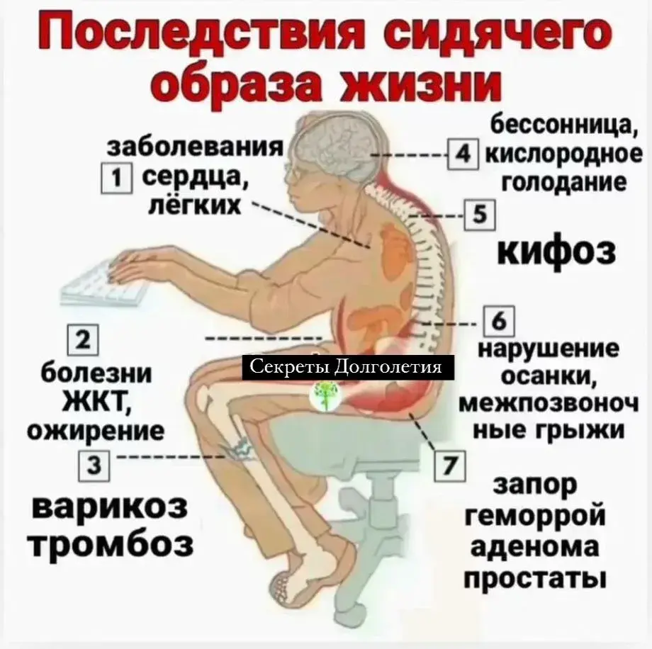 Последствия сидячего образа жизни