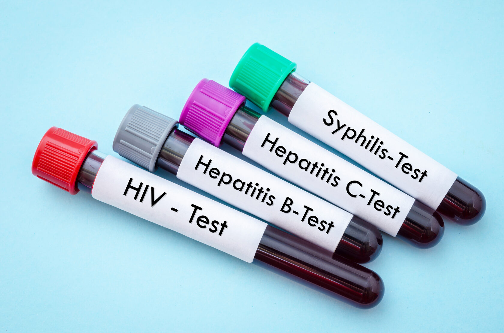 Кровь на вирусные маркеры. Пробирка на гепатит. ВИЧ пробирка.