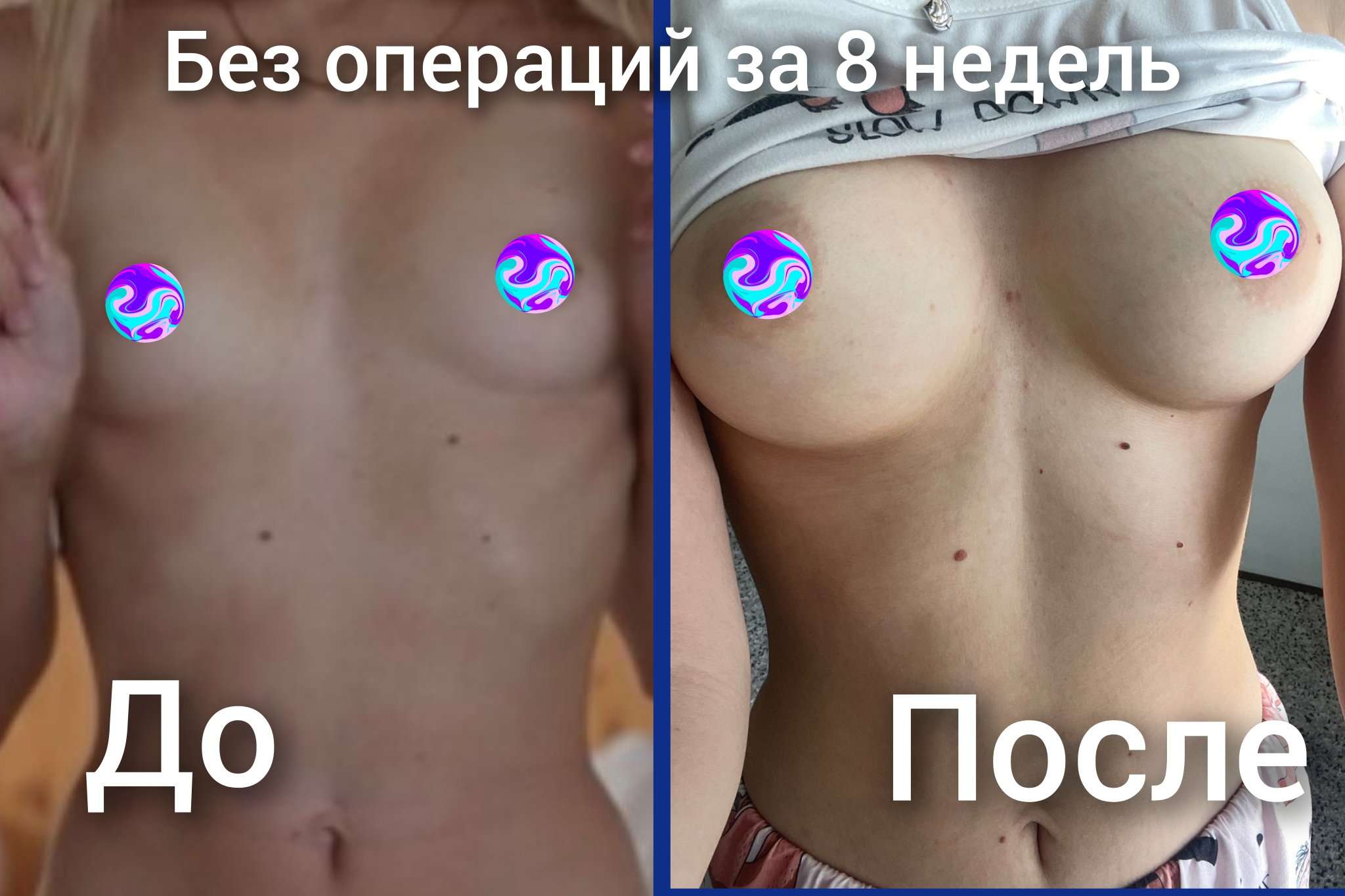 почему у женщин увеличивается грудь фото 106