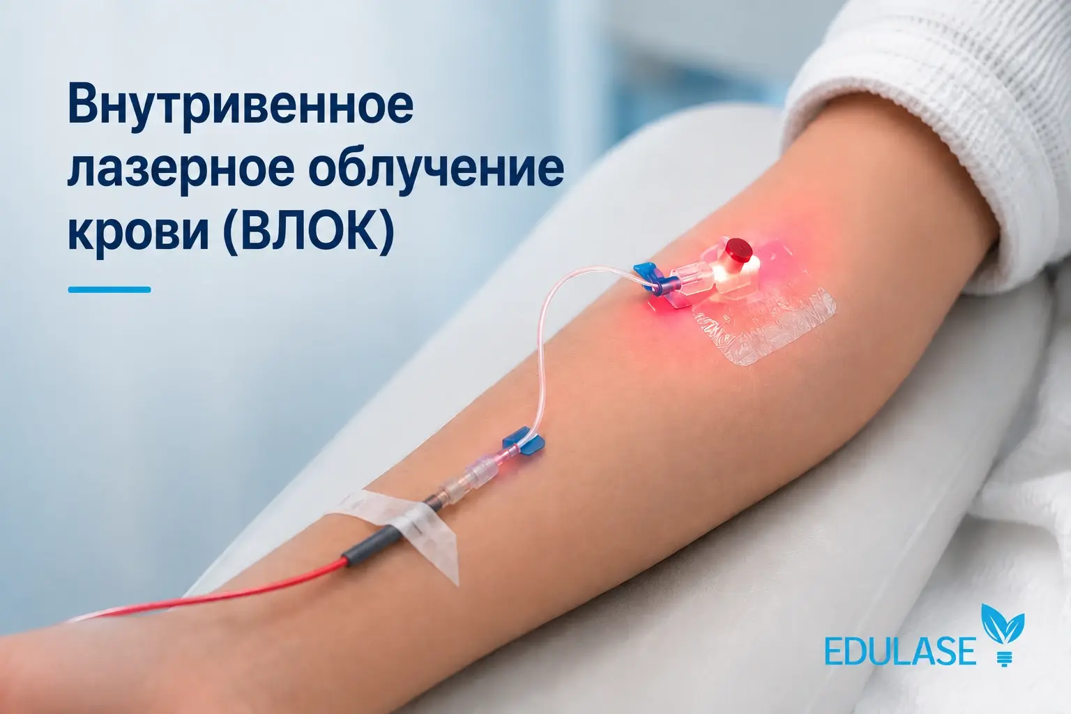 Внутривенное лазерное облучение крови ВЛОК — системная лазерная терапия.