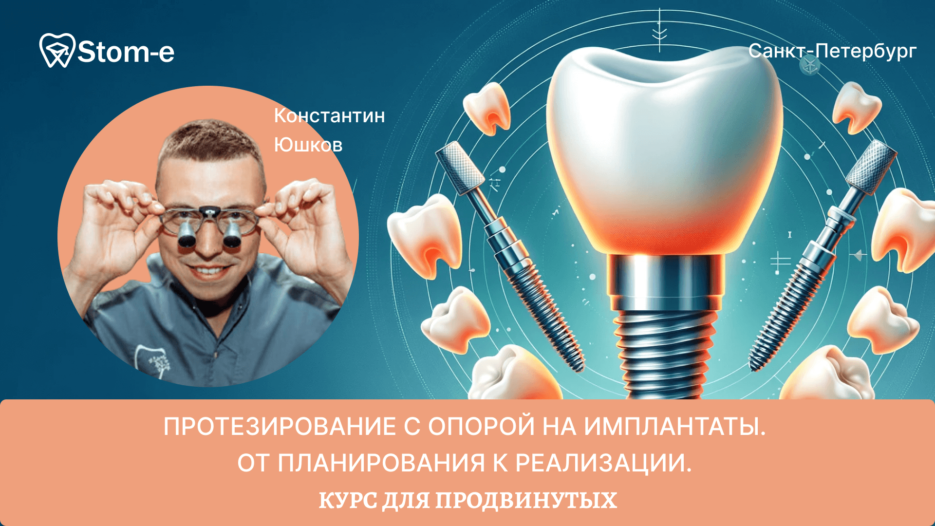 Протезирование с опорой на имплантаты. От планирования к реализации ...