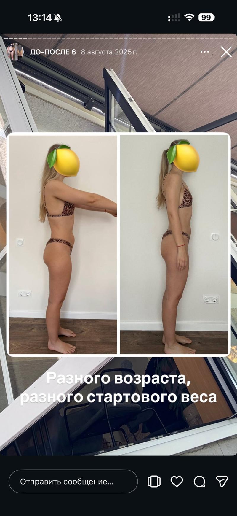 До и после ХМРЗ