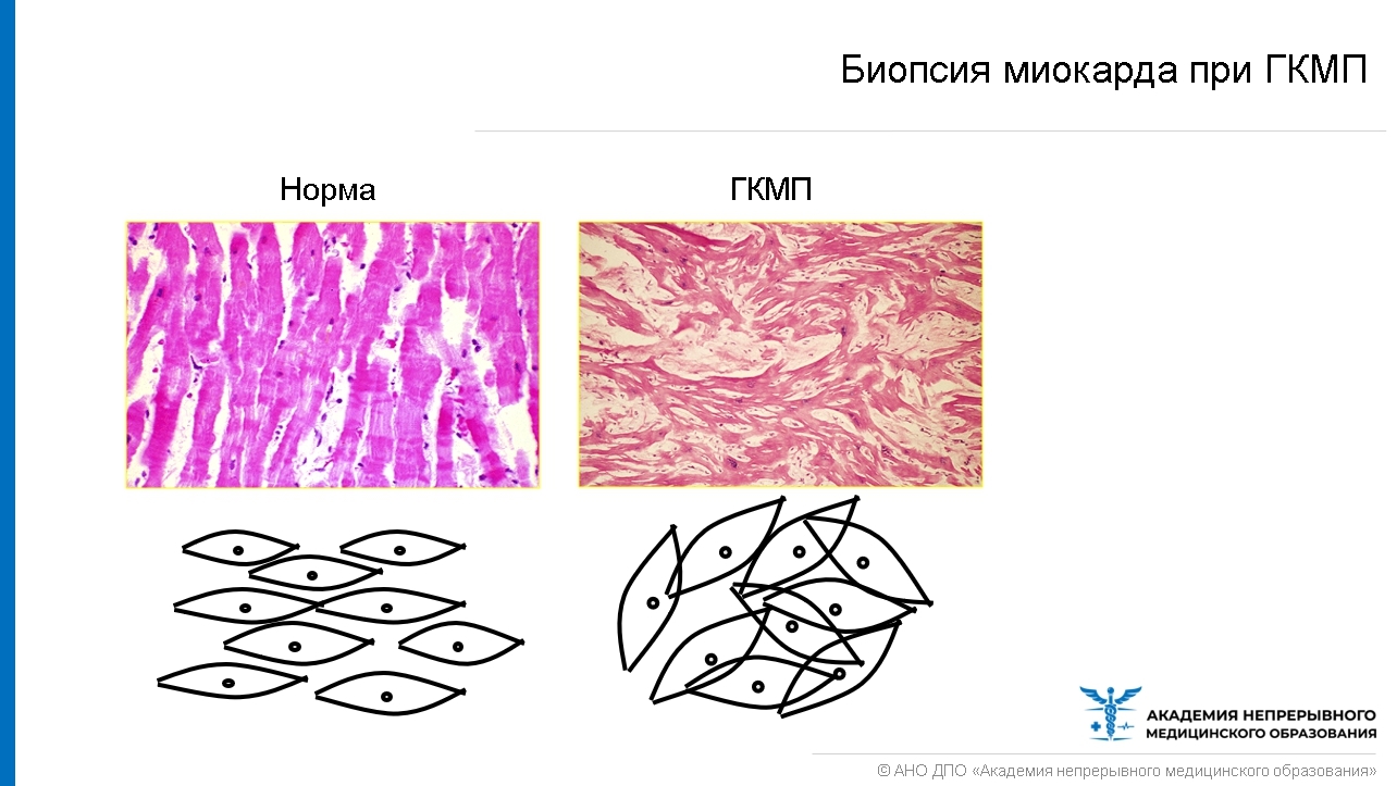 Миокард гистология рисунок