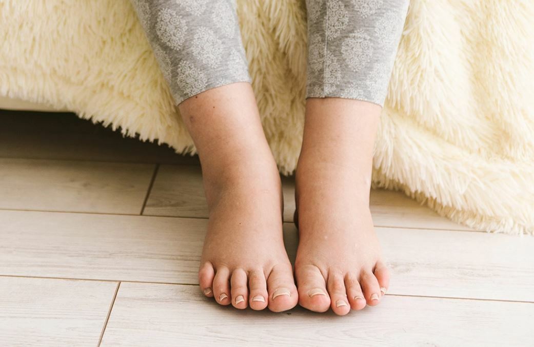 Как избавиться от отека и покраснения ног: причины, рекомендации | Статьи от Центра Флебологии