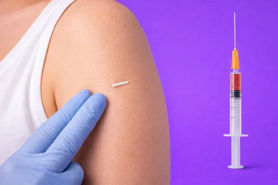 Подкожные импланты и инъекции